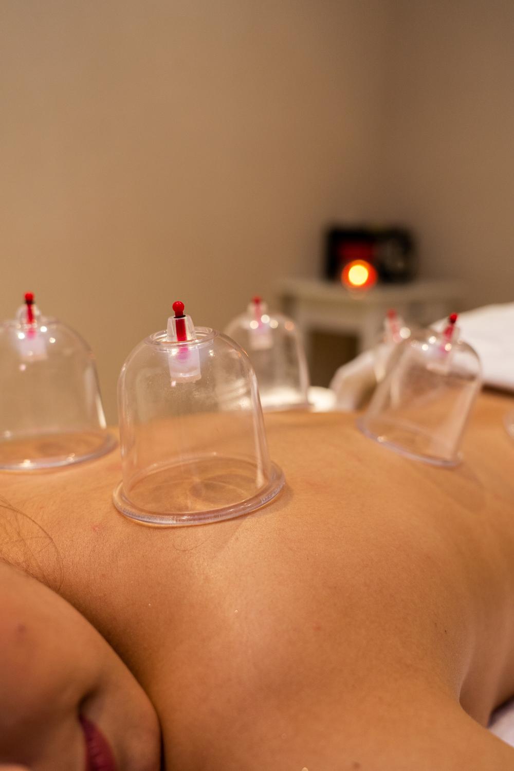 Cupping Massage